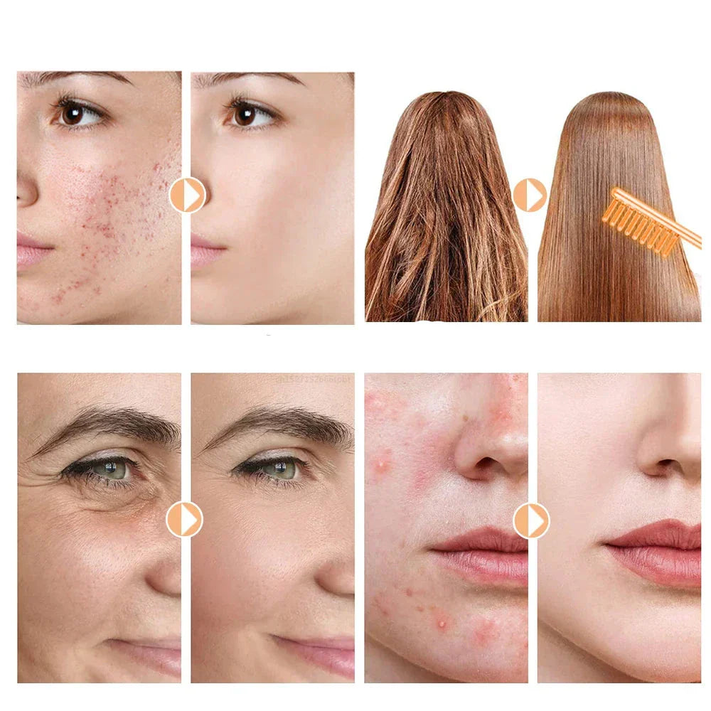 "Unisex high-frequency skin tightening wand for wrinkle reduction and acne treatment, featuring compact neon argon design."