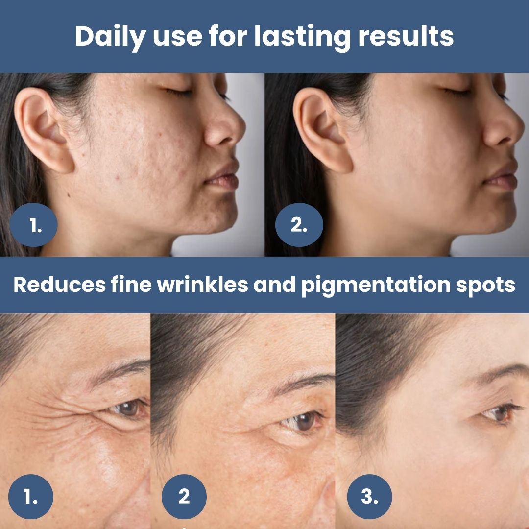 Glowing Skin LED Face Mask