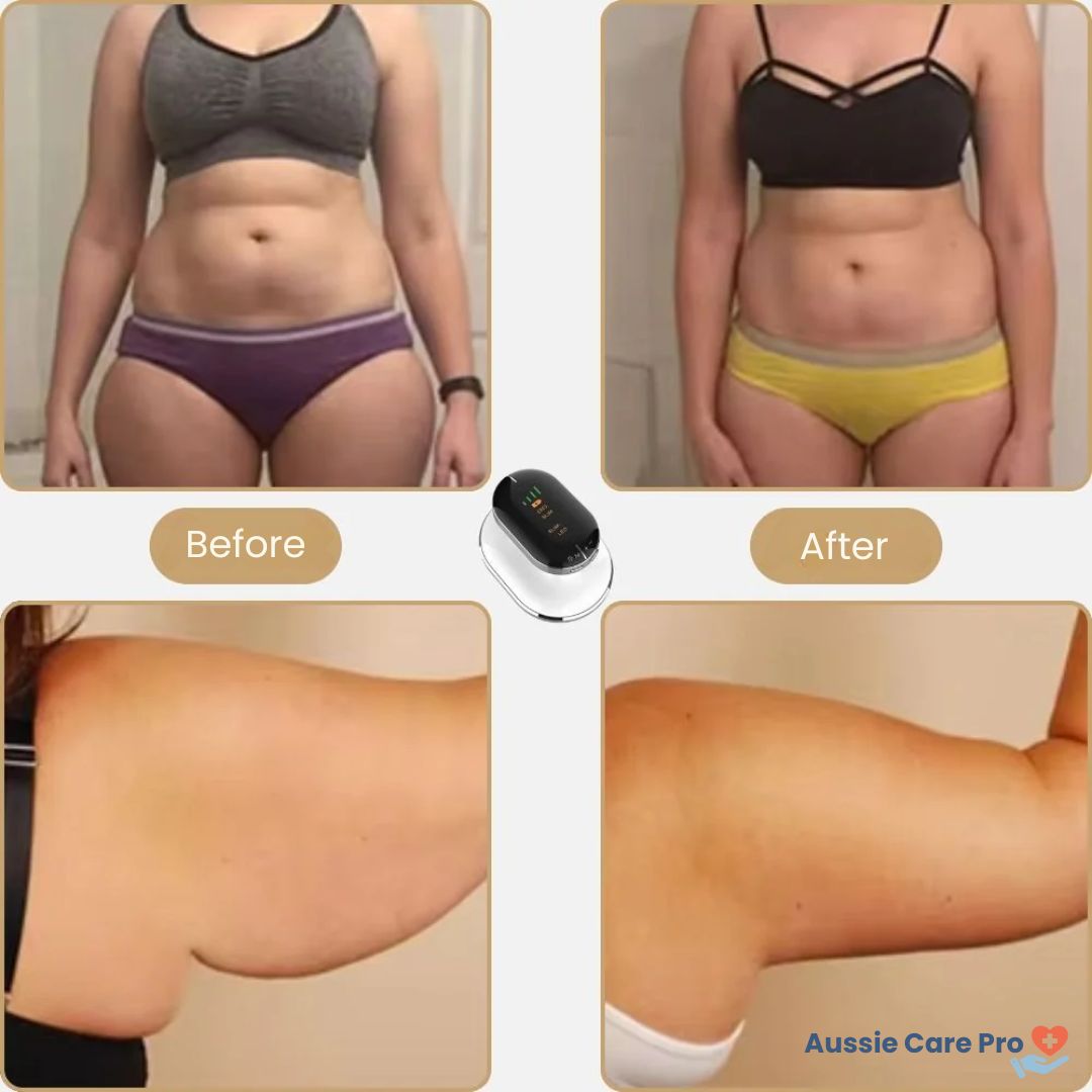 Compact Anti-Cellulite Massage Tool for Firming Skin