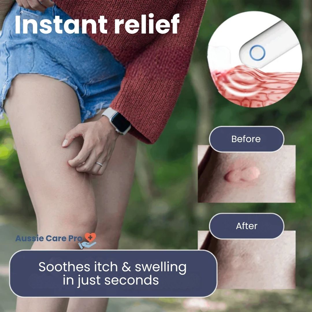 Itch Relief Pen for Bug Bites and Skin Irritations