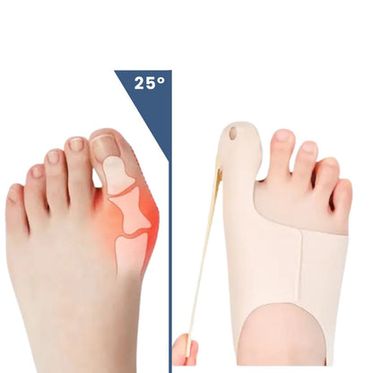 Comfortable Bunion Corrector for Easy Walking