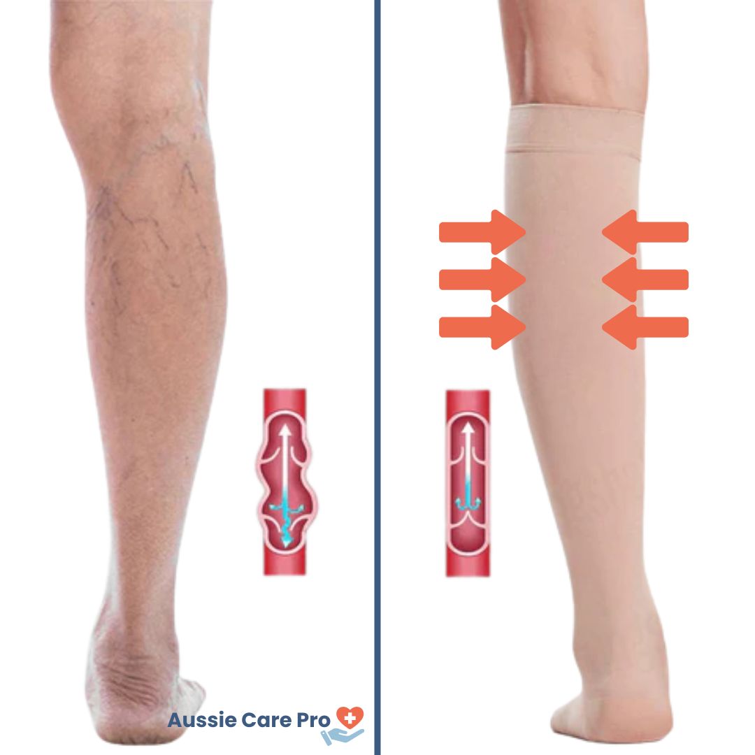 Breathable Open Toe Compression Socks for Improved Circulation
