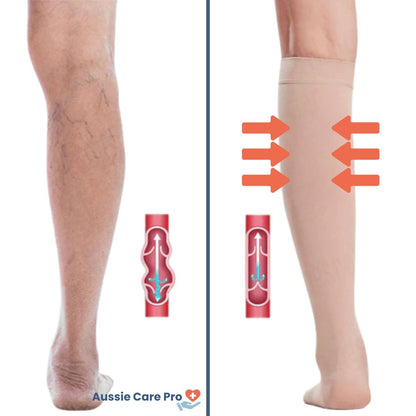 Breathable Open Toe Compression Socks for Improved Circulation