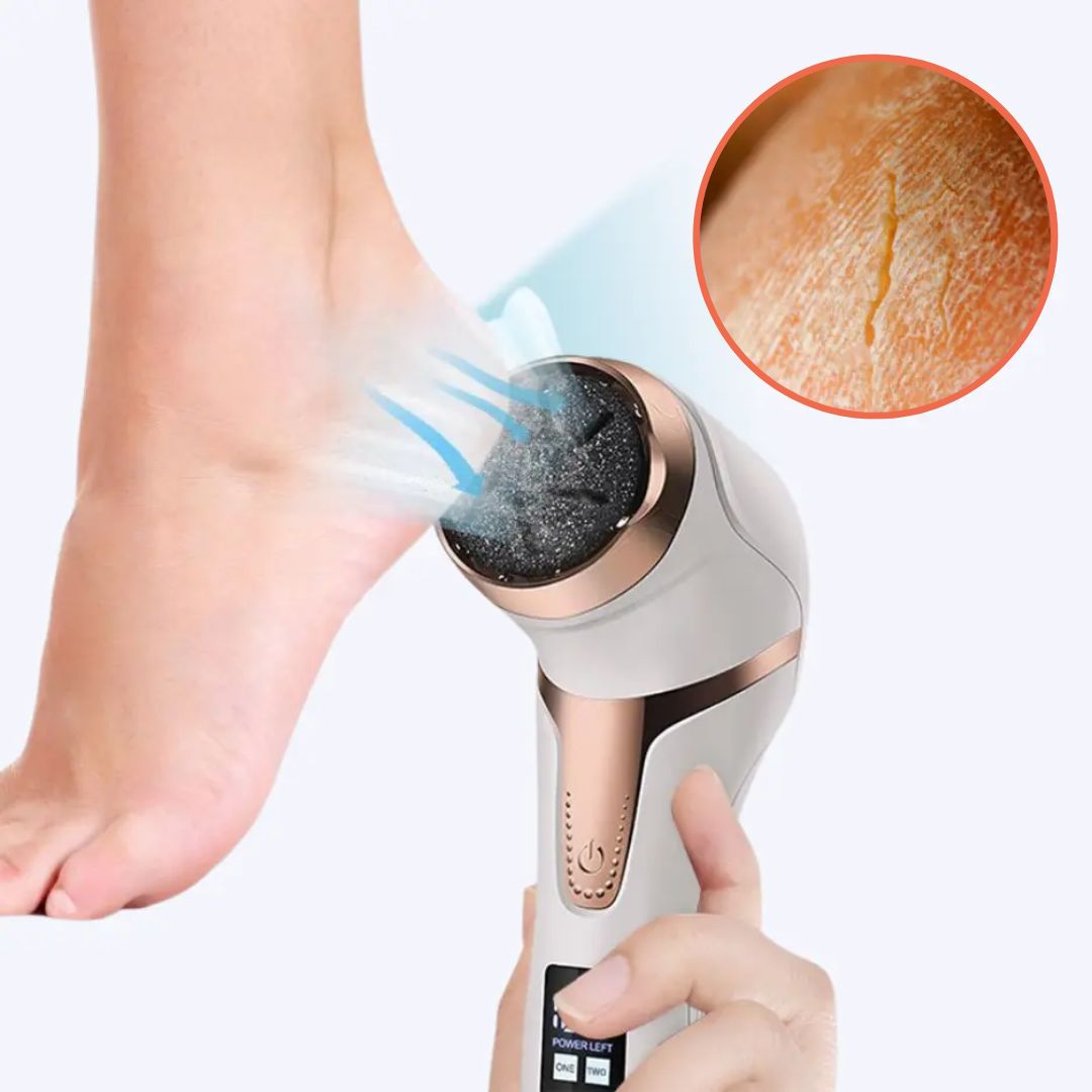 Easy Electric Foot Callus Remover