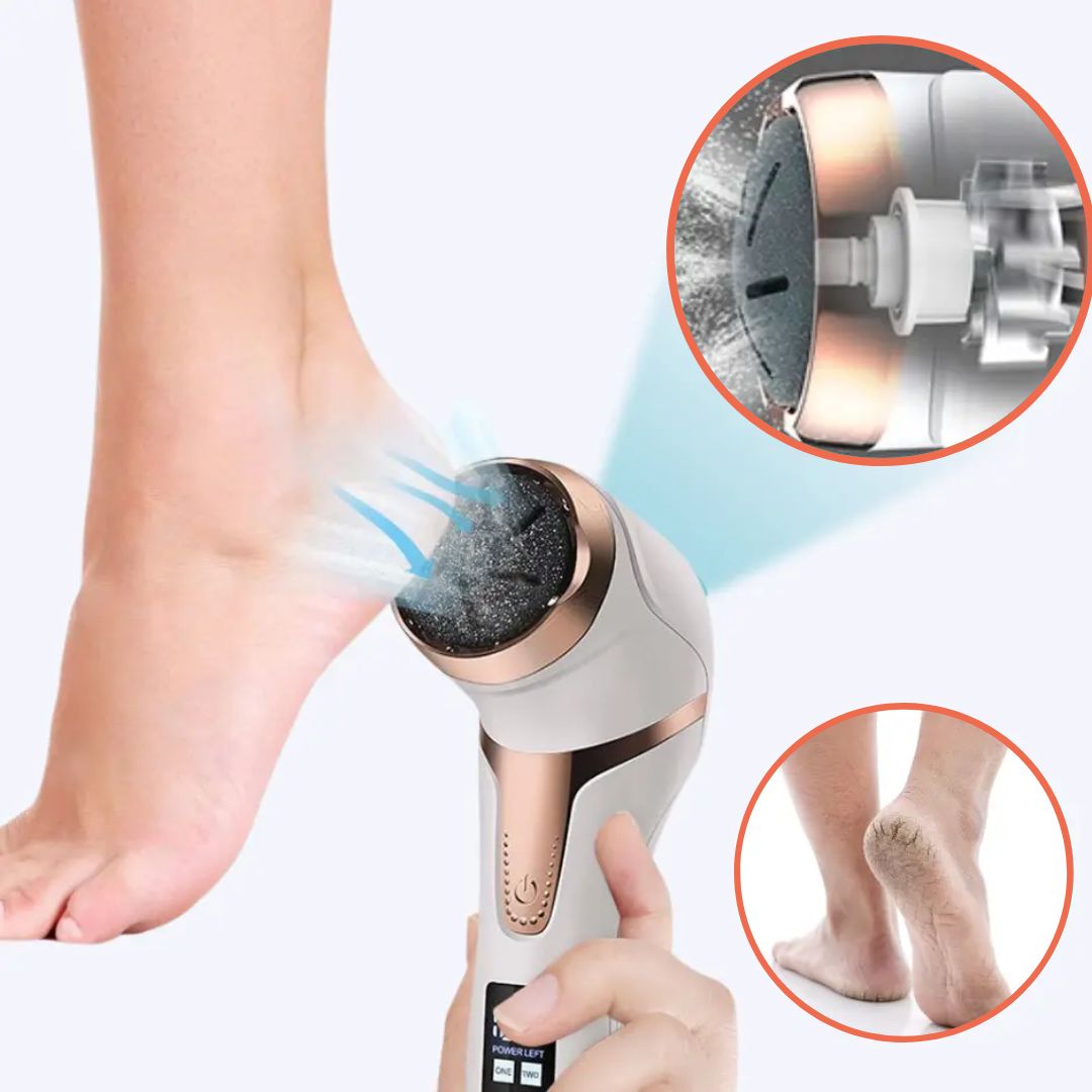 Easy Electric Foot Callus Remover
