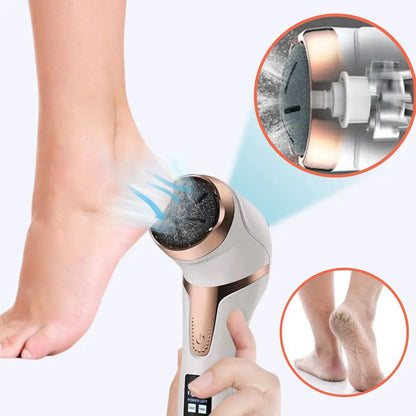 Easy Electric Foot Callus Remover