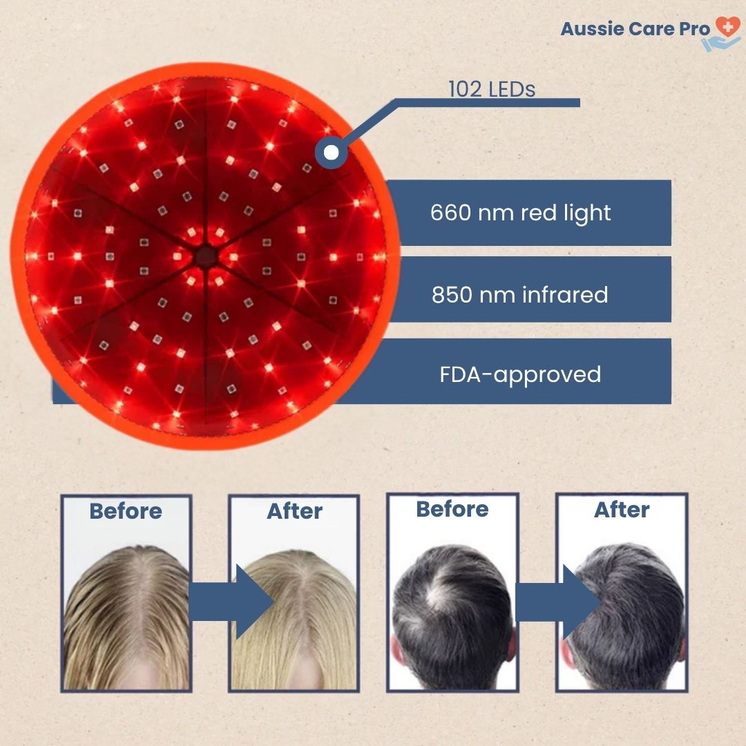 Advanced Red Light Therapy Hair Growth Cap