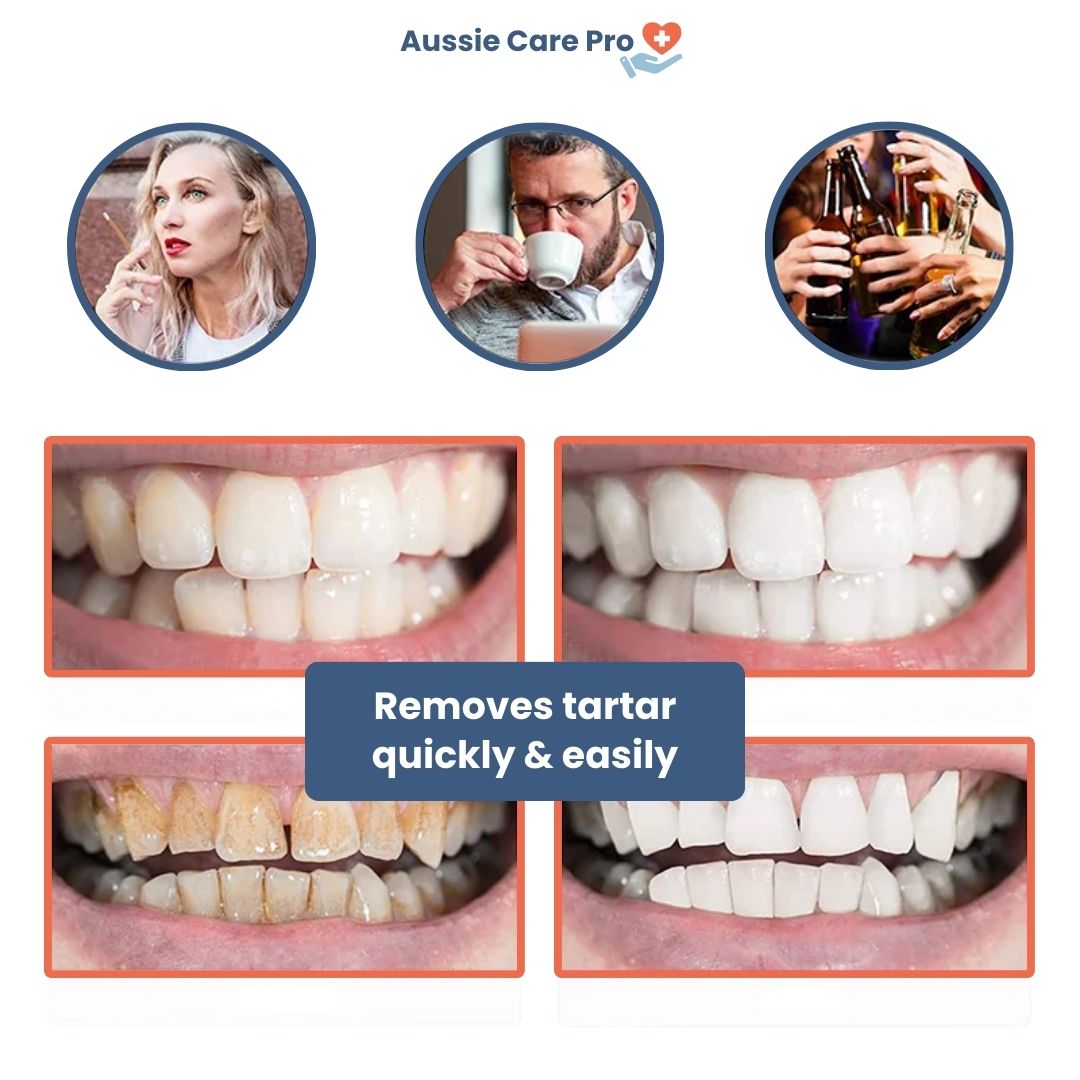 Advanced Dental Plaque Remover for Cleaner Teeth