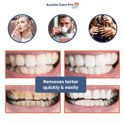 Advanced Dental Plaque Remover for Cleaner Teeth