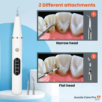 Advanced Dental Plaque Remover for Cleaner Teeth
