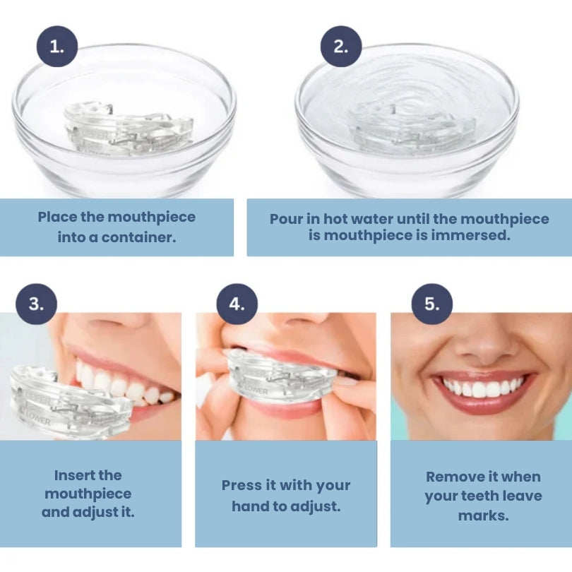 Stop Snore Anti Grinding Mouth Guard