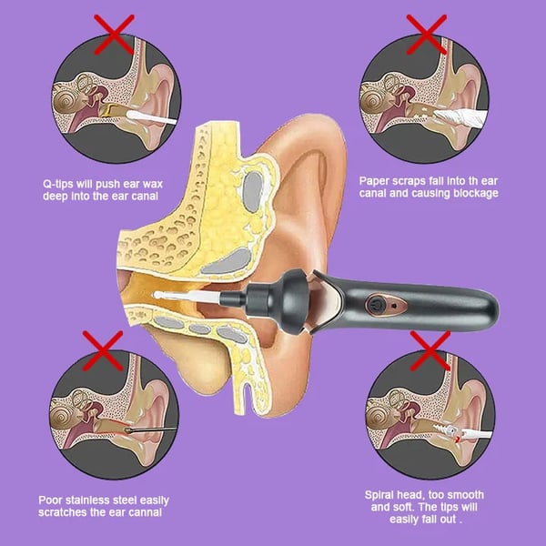 Easy Ear Cleaner Kit - Gentle Family Ear Care