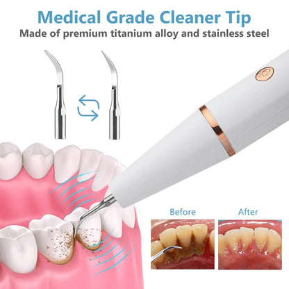 Effective Dental Plaque Remover - Advanced Tooth Cleaner