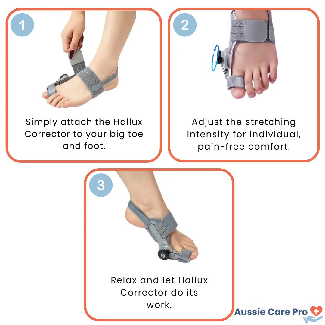 Comfortable Bunion Corrector Support