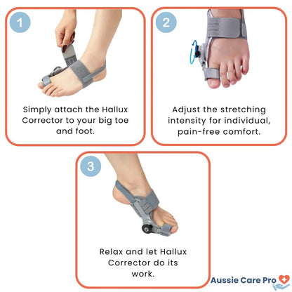 Comfortable Bunion Corrector Support