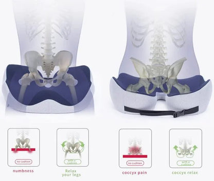 coccyx cushion/age uk pressure cushions/donut cushions/donut seat cushion/doughnut cushion/driving cushion/orthopedic cushion for sciatica/piles cushion/wheelchair comfort seat/coccy cushion/coccyx cushion for office chair/sciatica seat cushion for car/Pressure Relief Ergonomic & Orthopedic Seat Cushion, for Lower Back, Tailbone, Hip, Hamstrings, Sciatica Pain