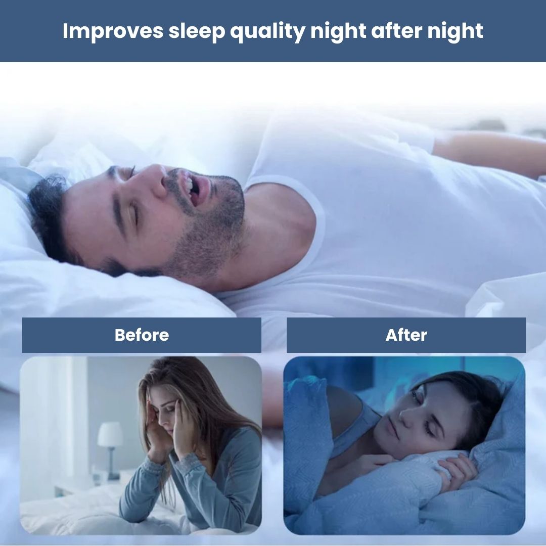 Snore Reducing Mouth Strip for Peaceful Sleep