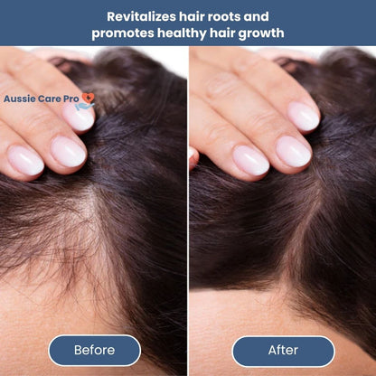 Advanced LED Hair Regrowth Cap - 96 Lights