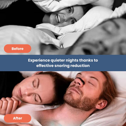 Premium Nasal Breathing Aid for Improved Sleep