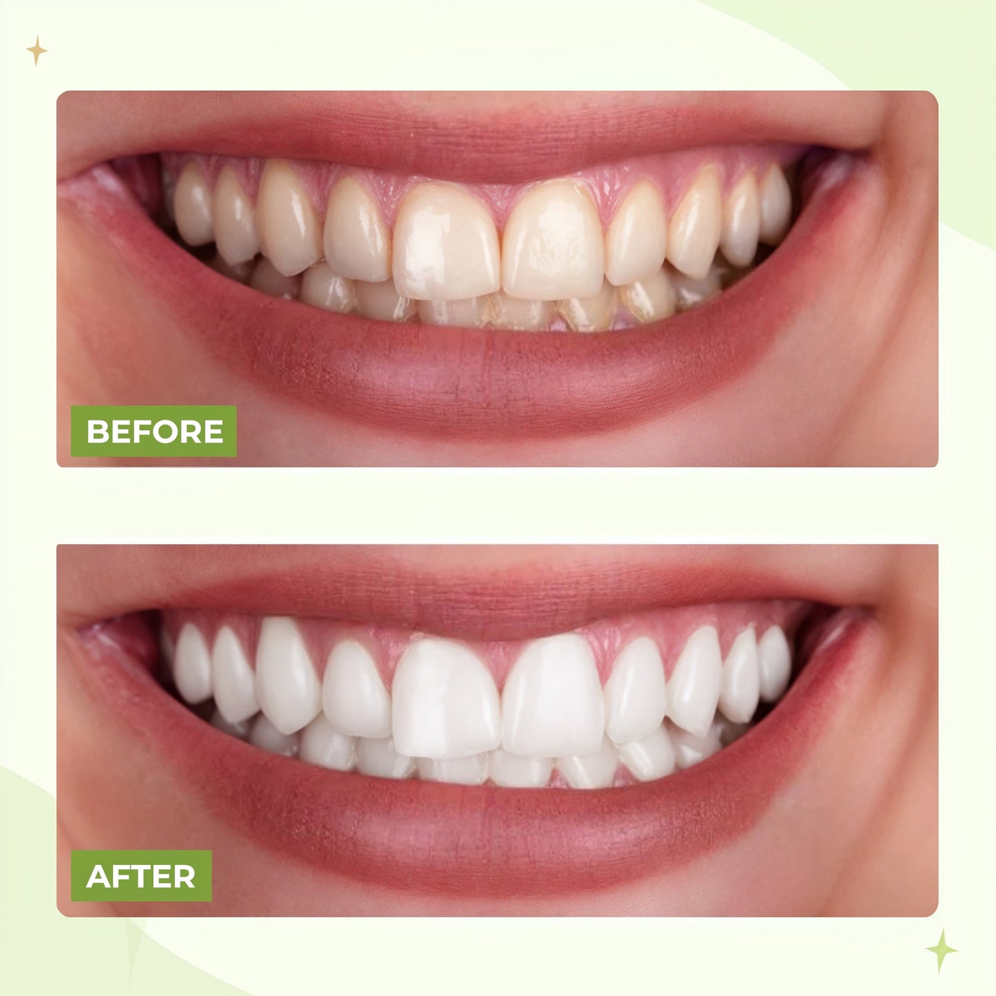 Portable Water Flosser for Teeth