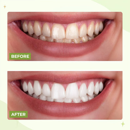 Portable Water Flosser for Teeth