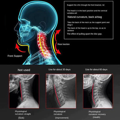 Soft Neck Support Collar Brace