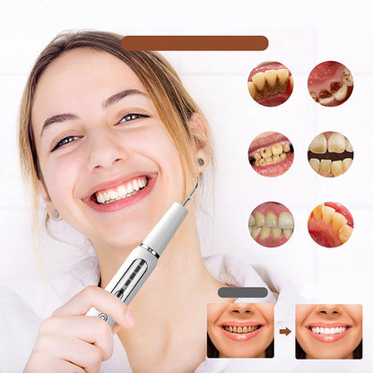 Advanced Electric Tooth Plaque Remover