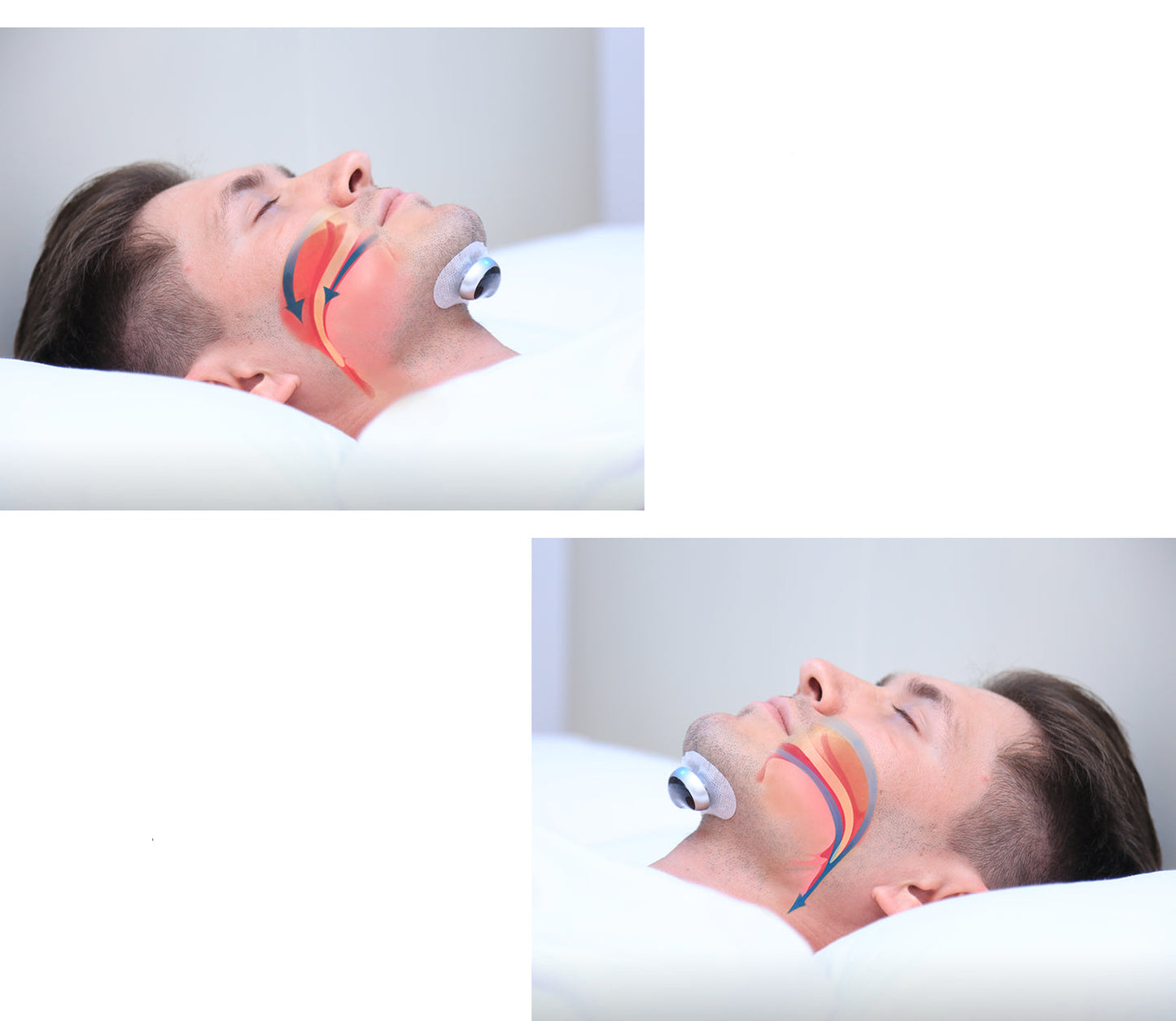 Compact Sleep Apnea Solution - Rechargeable & Bluetooth Enabled