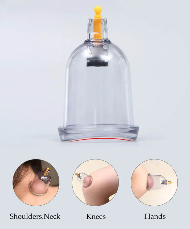 Pro Massage Cupping Therapy Kit