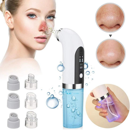 Pore Cleansing Facial Blackhead Removal Tool - Luxivelle