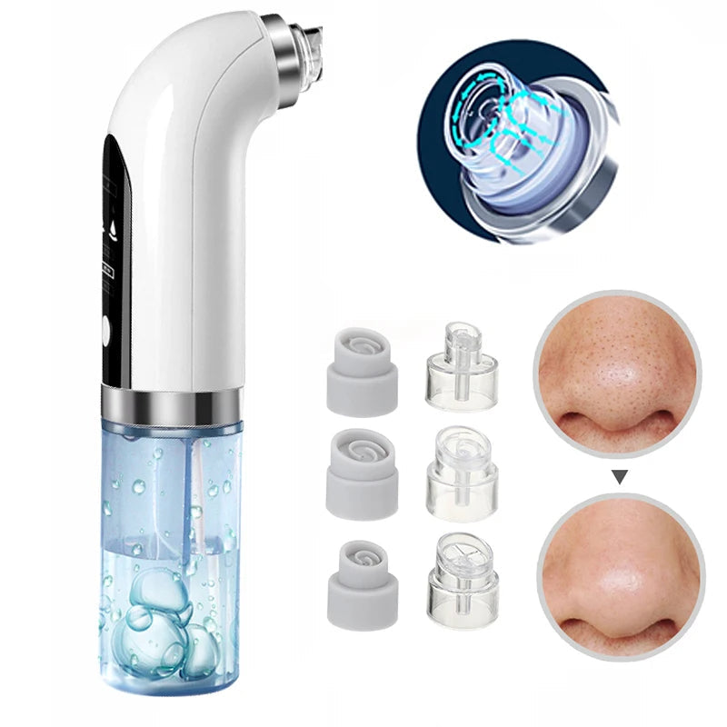 Electric blackhead remover pore vacuum on white background, featuring ergonomic design with interchangeable suction heads.