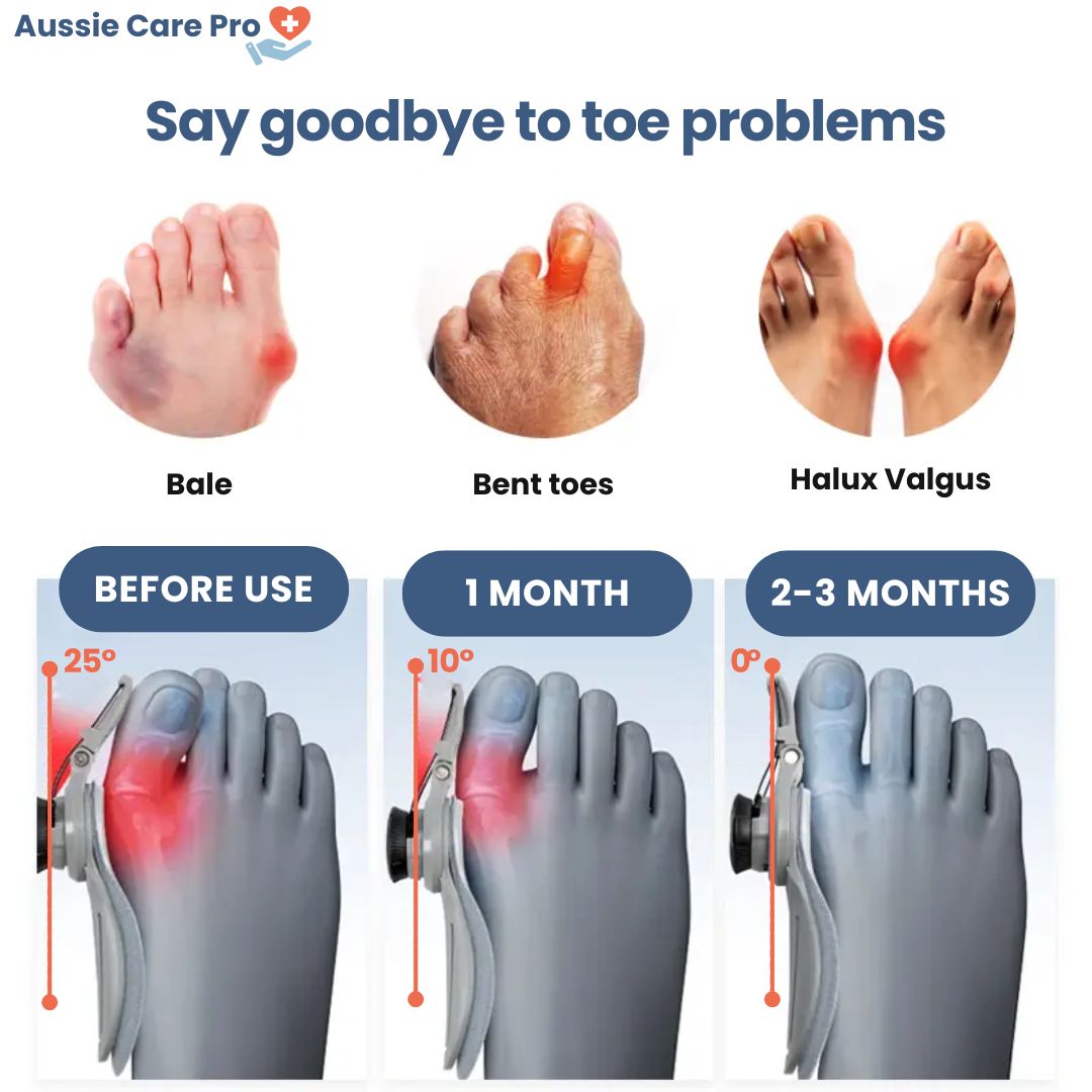 Comfortable Bunion Corrector Support