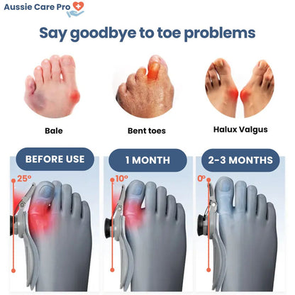 Comfortable Bunion Corrector Support