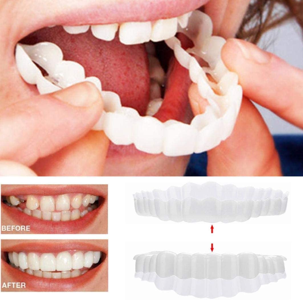 Natural Teeth Veneers Kit - Full Set Included - Luxivelle