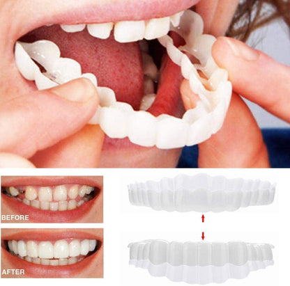 Natural Teeth Veneers Kit - Full Set Included - Luxivelle