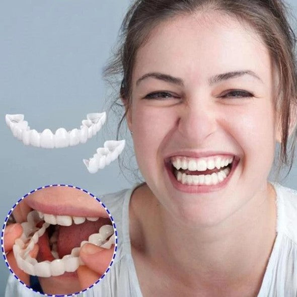 "Smile veneer set with upper and lower pieces, natural white finish, for beauty and wellbeing, transforms imperfect teeth."