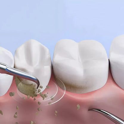 Ultrasonic dental plaque remover with stainless steel heads, designed for precision cleaning and tartar removal at home.