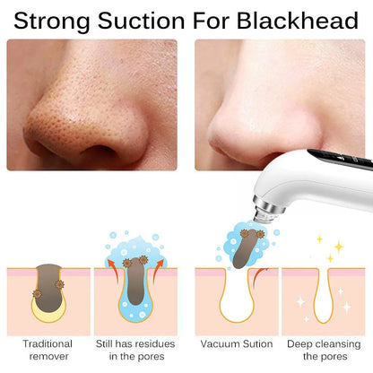 "Unisex electric blackhead remover vacuum, sleek design, adjustable suction for skin cleansing, front view."