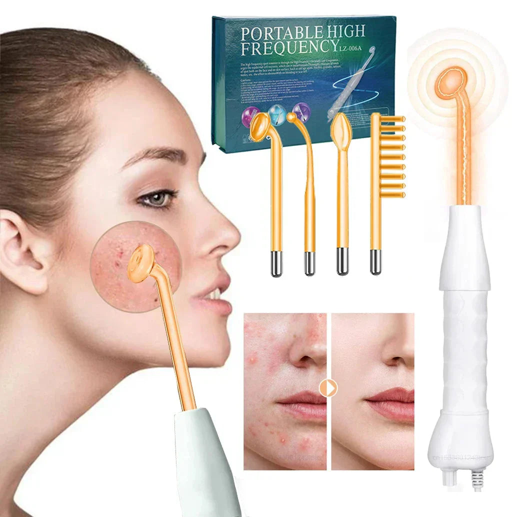 Professional Facial Skin Tightening Device - Luxivelle